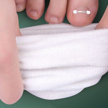 Коректор за извити нокти на краката Адхезивна лепенка Комплект за врастнали ремонти Стикер за лечение на растеж