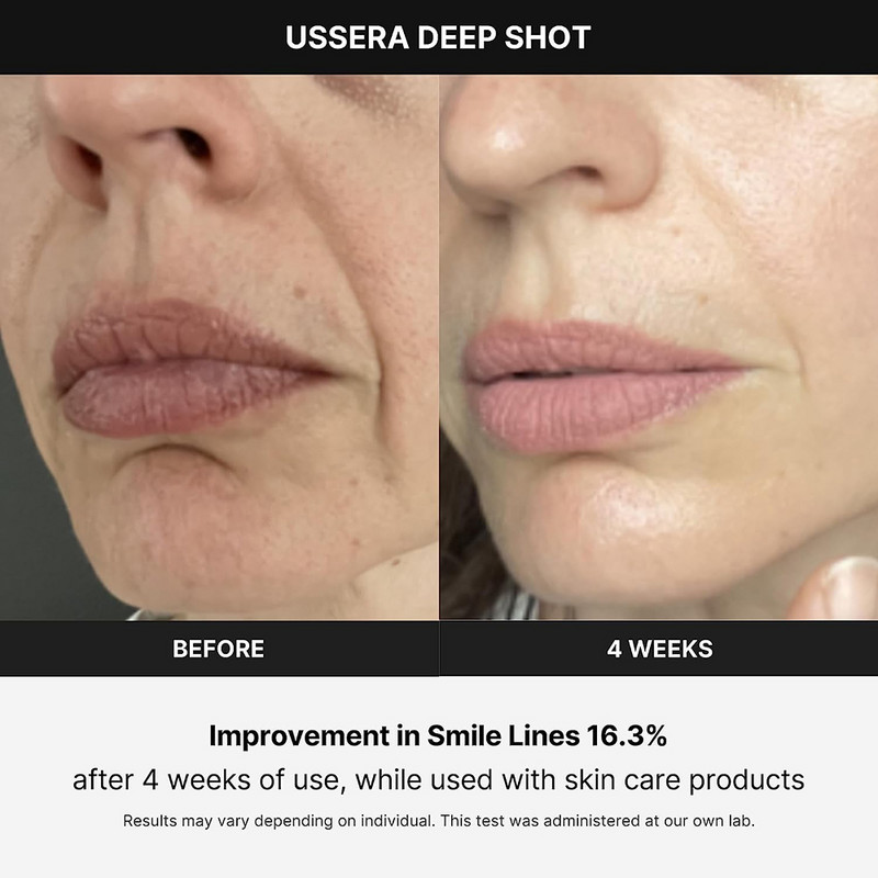 NAUJAS „Mini HIFU Machine 4.0“ ultragarso aparatas RF radijo dažnio EMS mikrosrovės kėlimo stangrinamasis odos raukšlių odos priežiūra