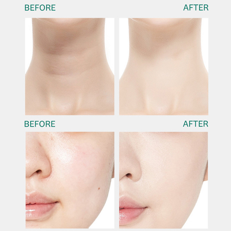 Multifunktsionaalsed iluseadmed kortsudevastased kaela näohooldus silmad tõstev massaaž induktsioonnaha noorendamine naha pinguldamine masin