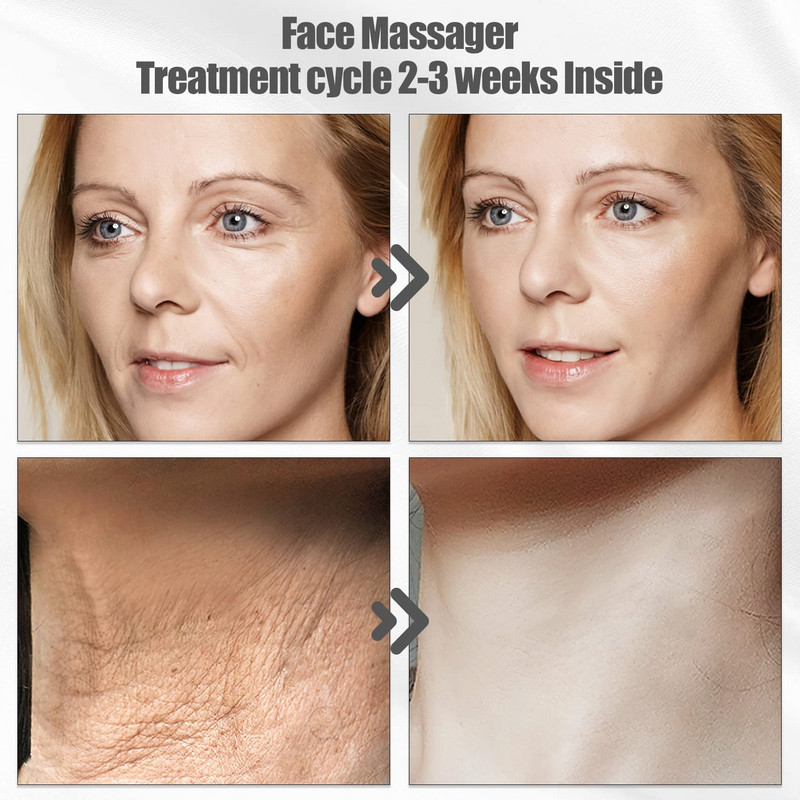 EMS veido pakėlimas, kaklą stangrinantis vibratorius, odos priežiūra raudonos šviesos terapija, IPL atjauninimas, grožis nuo raukšlių veido masažuoklis