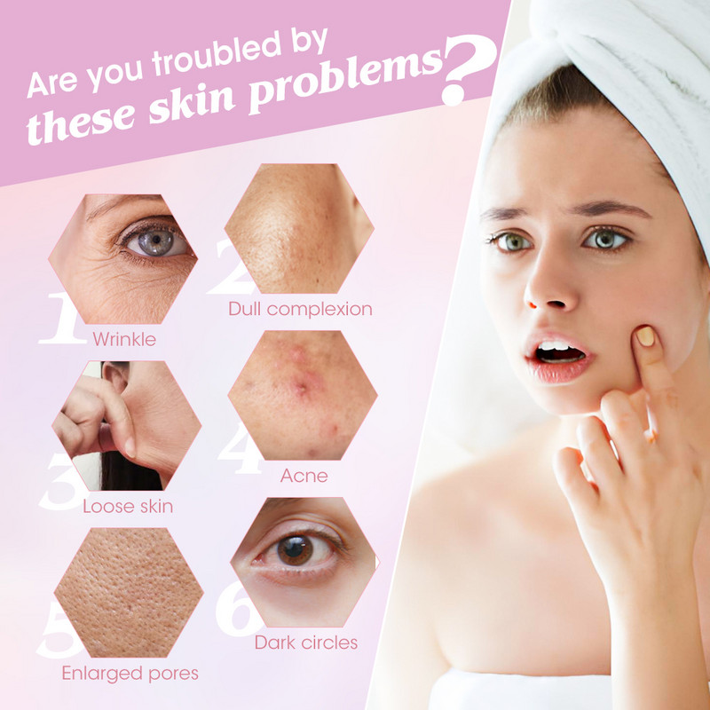 Daugiafunkcinis RF 4 spalvų šviesos odos atjauninimo instrumentas buitinis veido importuotojas mikro srovės liftingo grožio prietaisas