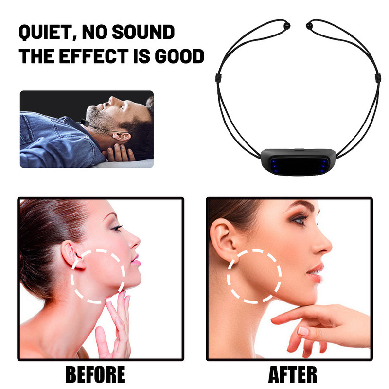 2023 m. „V-Face Beauty Device“ Išmanusis elektrinis V formos veido formavimo masažuoklis, skirtas pašalinti dvigubą smakrą miegančiosios gražuolės prietaiso odos priežiūrai