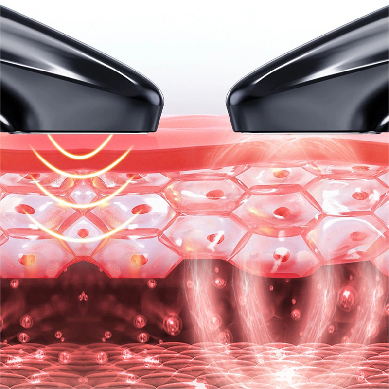 Osoon külma plasmapliiatsiga akne eemaldamine tundlikule nahale kortsudevastane sinine hele sügav akne puhastusvahend, mis kõrvaldab akne kahanevad poorid Ilu