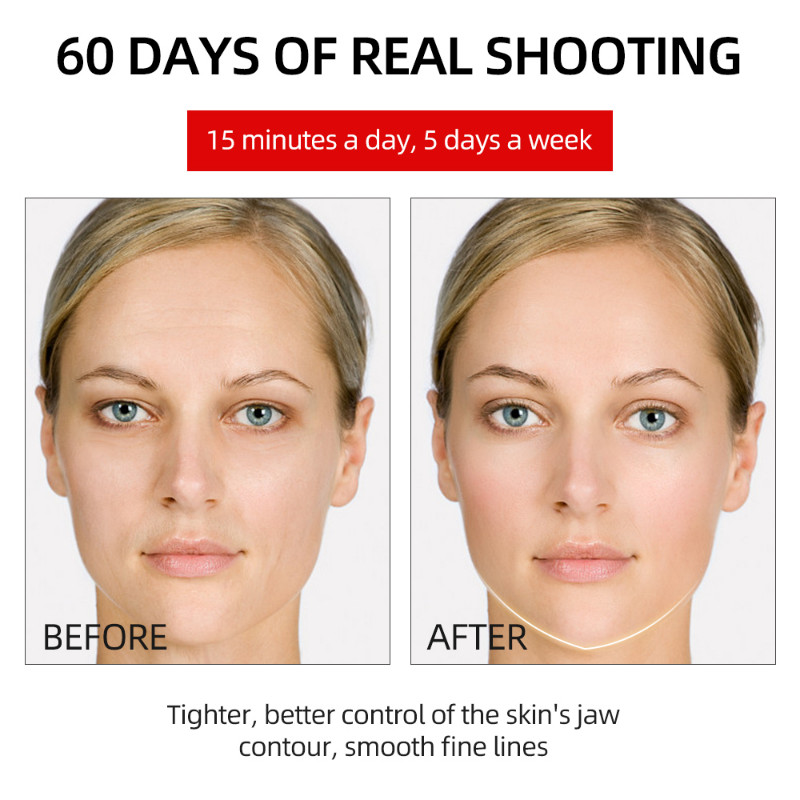 EMS V Masažer za podizanje lica LED fotonska terapija Mršavljenje čeljusti Zatezanje Vibracijski lift Uklanjanje duple brade Uređaj za masažu lica