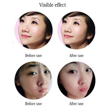 Professional Fibroblast Pen Plasma Lifting Eyelid Beauty Medical Skin Lifting Electric Skin Skin Tags Mole Remove Tool