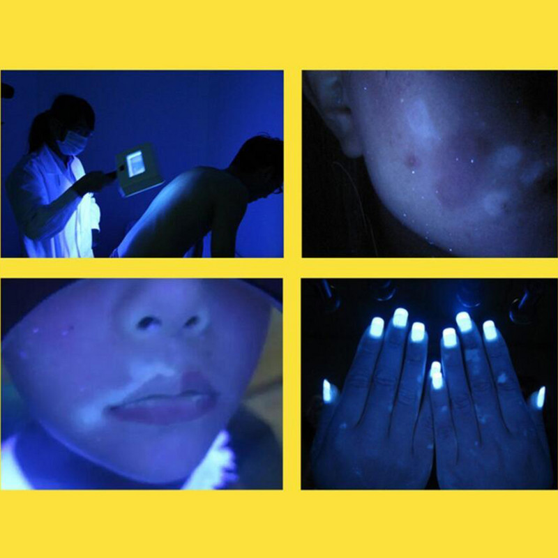 Analizor de piele pentru testare a pielii faciale de frumusețe cu glugă de blocare a luminii Revizuire facială Rozacee Lumin bărbați Kit pentru bărbați Acnee expusă