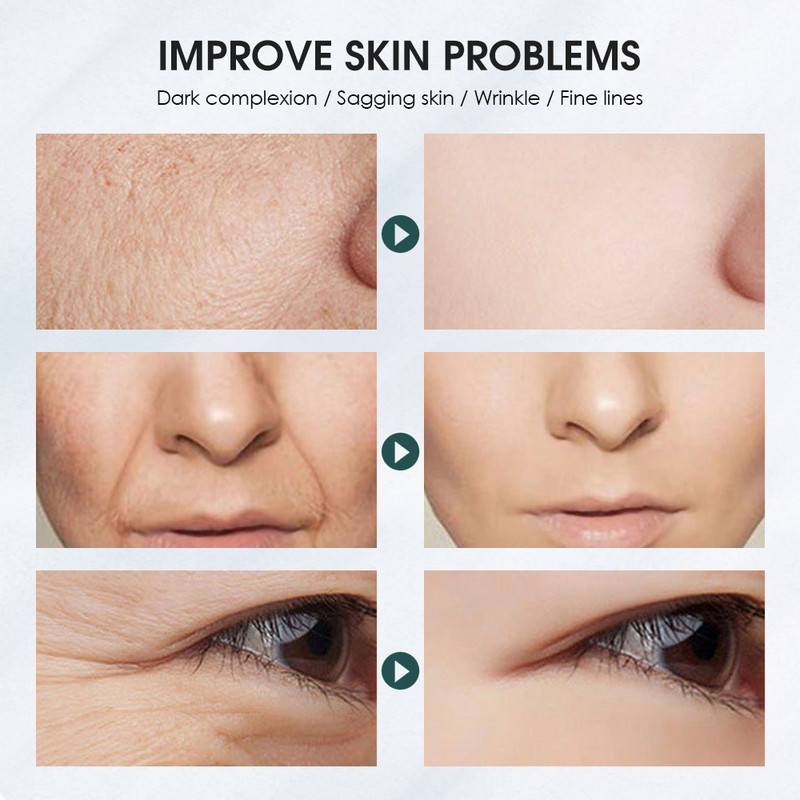 Naujas EMS Pulse Face Beauty prietaisas Veido atjauninimas Magnetinė terapija Lifting Tighten Vibration Masažas Priešraukšlinė odos priežiūra