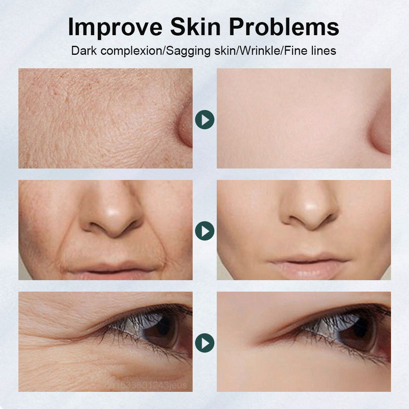 RF Lifting Machine nahka pinguldav EMS näo tõstev masseerija 7-ühes naha noorendamine näo raadiosageduslik näo tõstmise seade