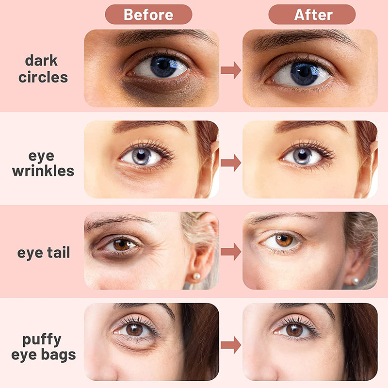 4 u 1 štapić za lice Mikrostrujni toplinski terapeutski 360° rotirajući štapić za uljepšavanje očiju za smanjenje bora Alat za njegu kože lica protiv starenja