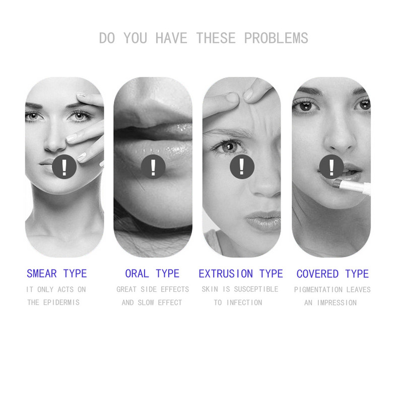 Minimalism 7 värvi LED-näomask Fotoonteraapia Aknevastane Kortsude eemaldaja Naha noorendamine Näo Nahahooldusvahendid