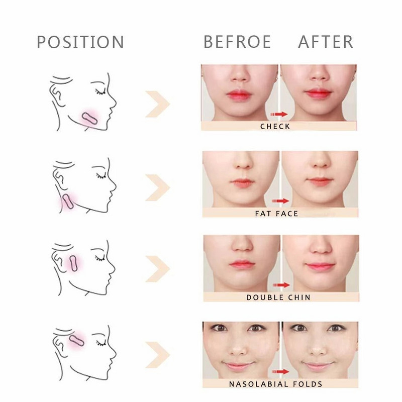 Smakro veido pakeliamoji juosta Veido klijai Nematomi ploni veido lipdukai V formos veido linija raukšlių suglebimas Veidas Veido pakėlimo priemonės Priežiūra