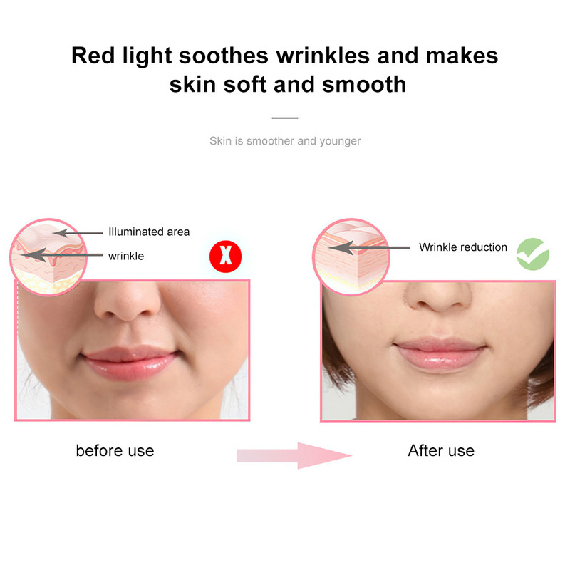 Veido odos priežiūros prietaisas Veido masažuoklis plaktukas Ultragarsinė krioterapija veido vibracija raudonos šviesos jonų grožio priemonė