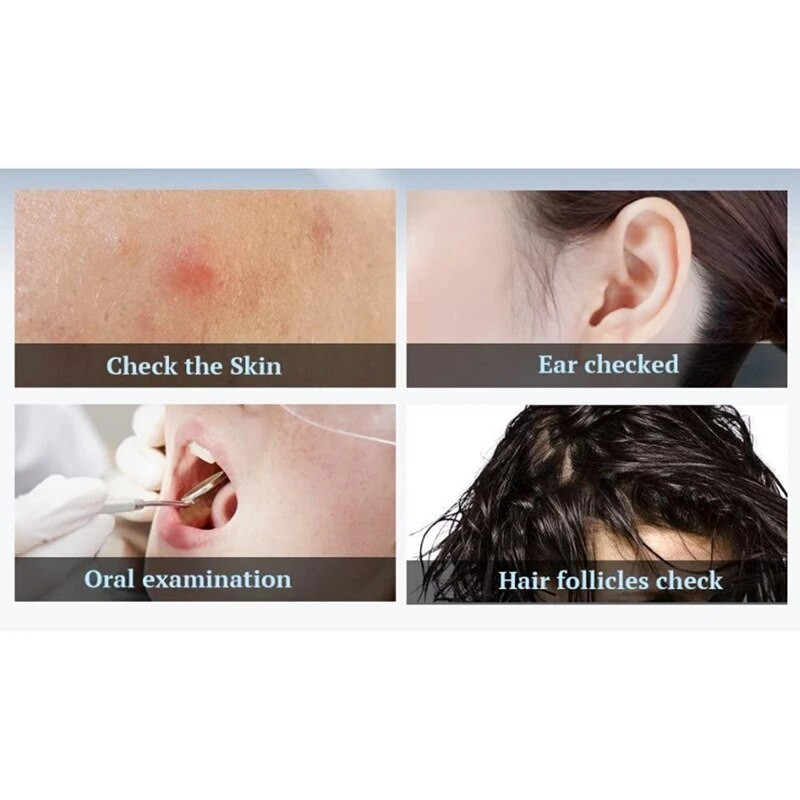 5,5 Mm veterinarijos otoskopo kamera Vaizdo otoskopo valiklis vaško valiklis Mini Vision ausų antgalio fotoaparatas