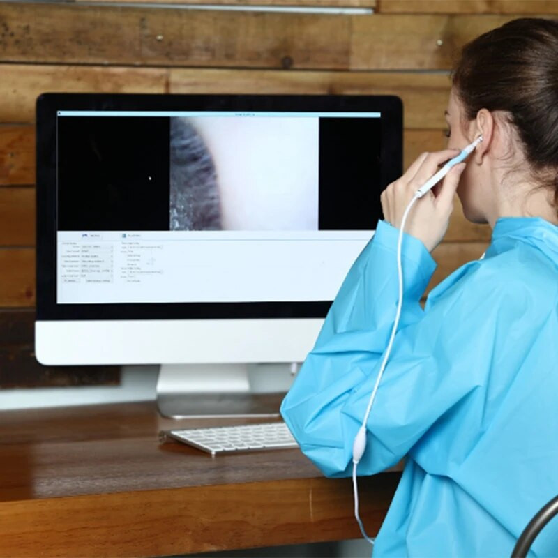 5,5 Mm veterinarijos otoskopo kamera Vaizdo otoskopo valiklis vaško valiklis Mini Vision ausų antgalio fotoaparatas